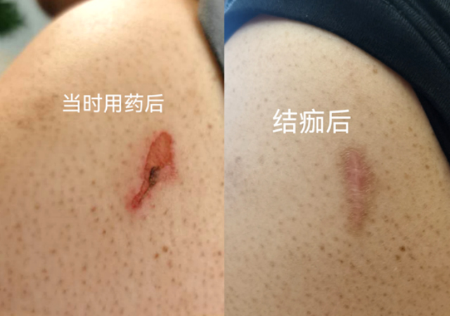 案例一.jpg