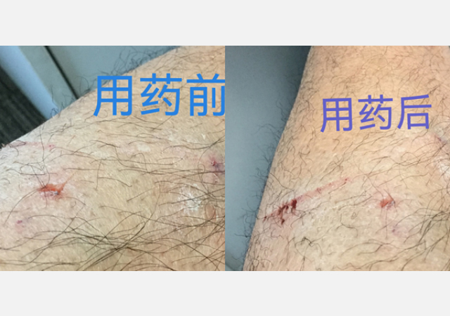 案例四.jpg